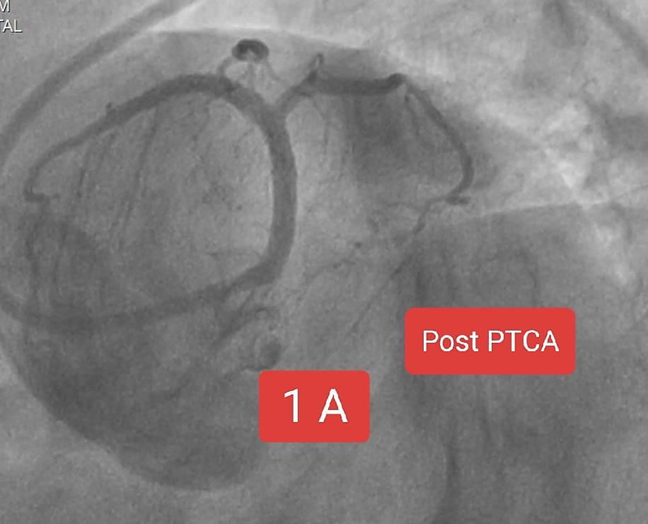 Heart Health Checkup